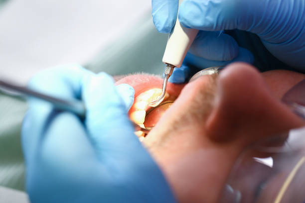 Best Cracked Tooth Emergency Dentist  in Fontana, CA