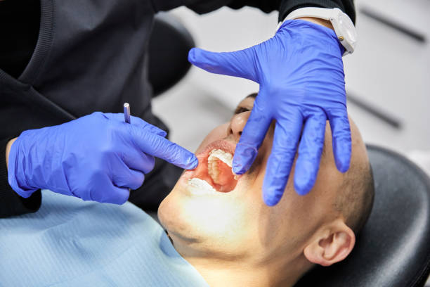 Best Urgent Tooth Repair  in Fontana, CA